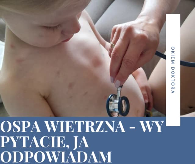 Kiedy po ospie do przedszkola? Sprawdź, kiedy dziecko może wrócić Kiedy po ospie do przedszkola? Sprawdź, kiedy dziecko może wrócić